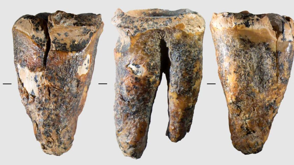 Neanderthal molar with evidence of ancient dental treatment