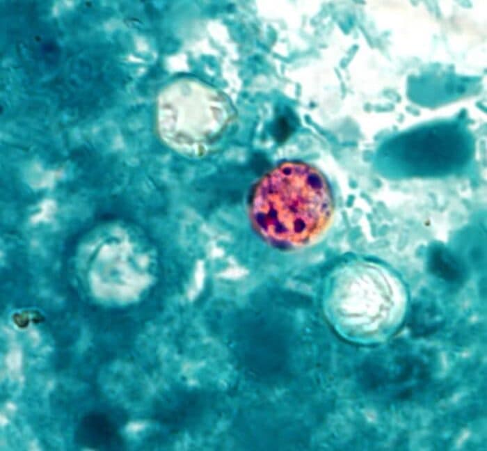 FDA investigation into cyclospora outbreak affecting 72 individuals
