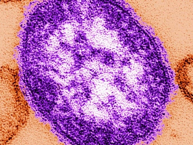 First Measles Deaths in the US for 2026 Reported in Pennsylvania Amid Outbreak