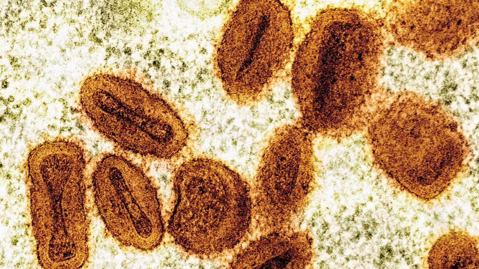 Scientists charged with smuggling deactivated mpox virus vials in the U.S.