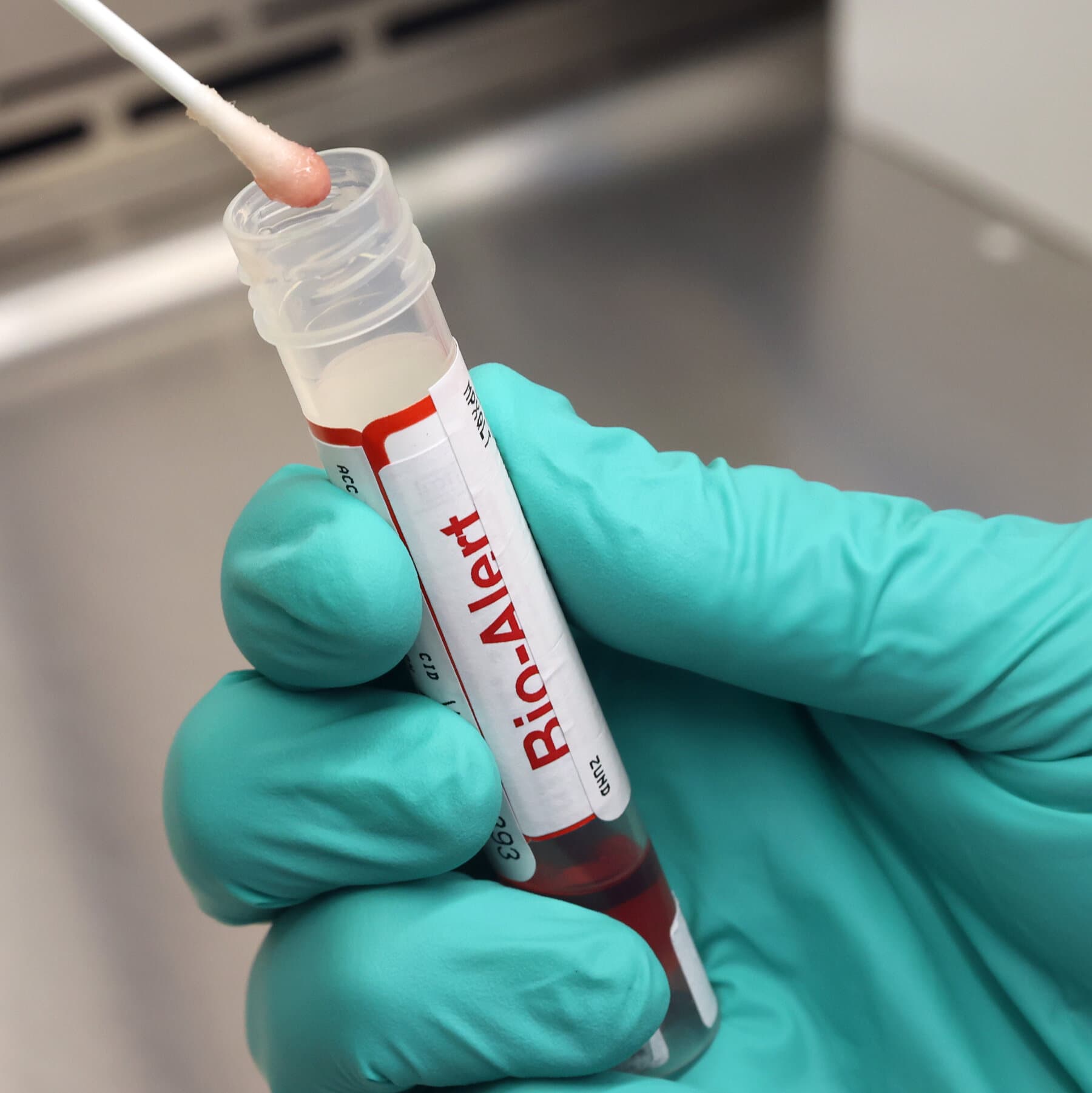 CDC Temporarily Suspends Diagnostic Testing for Rabies and Pox Viruses Due to Staffing Shortages