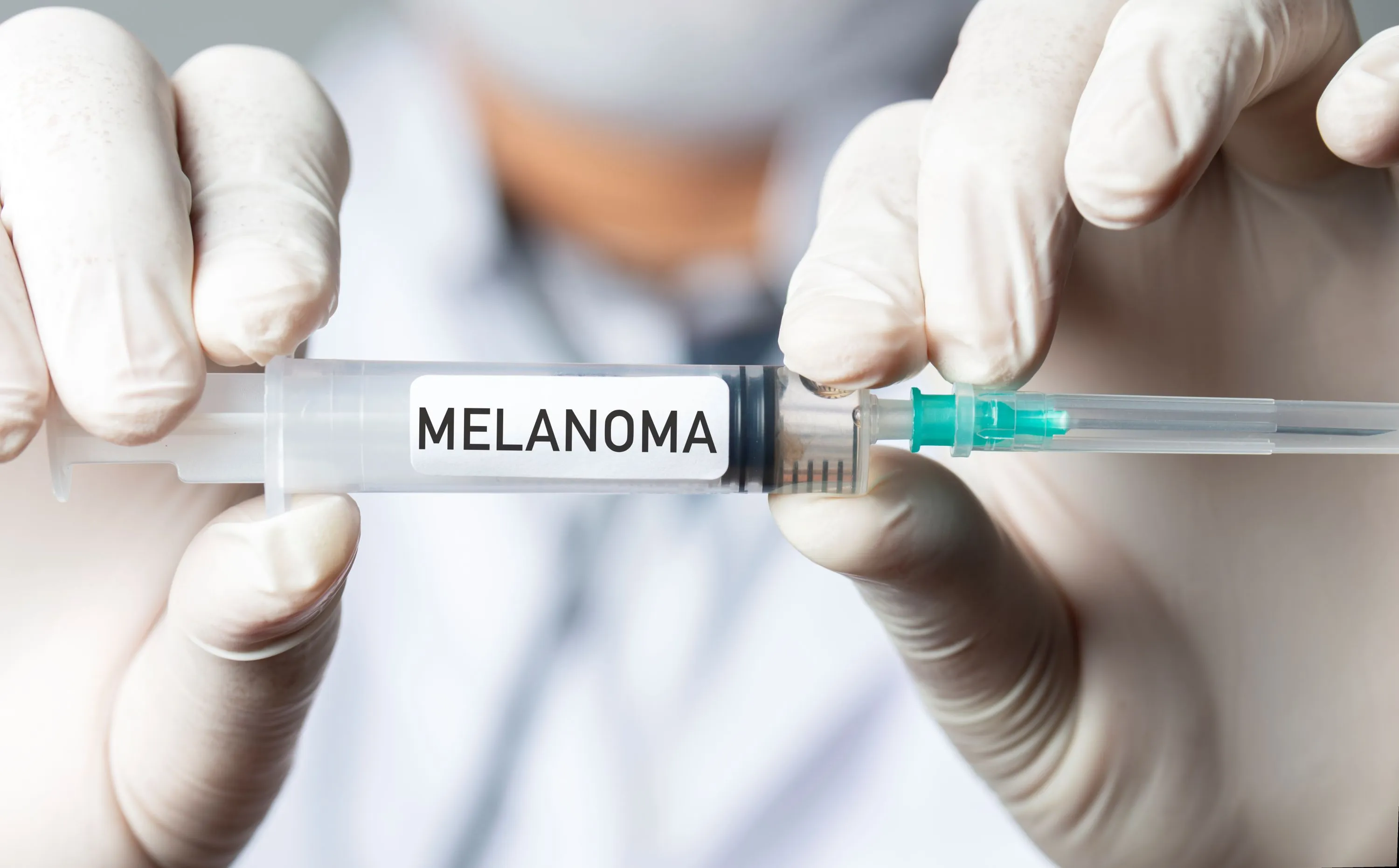 Infographic showing the 42% reduction in melanoma recurrence risk with the new personalized mRNA vaccine.